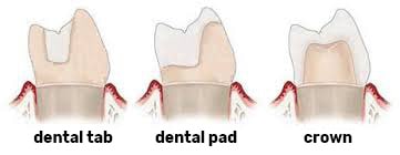 Micro-prosthetic dentistry
