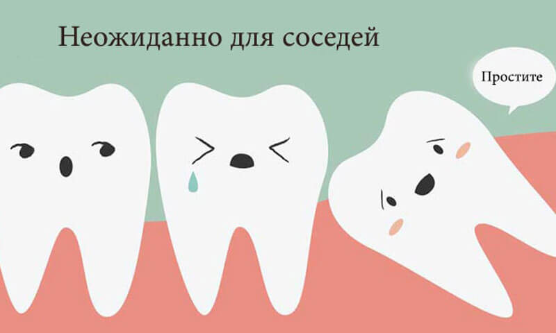 Почему бытует мнение, что зубы мудрости трудно удалять?